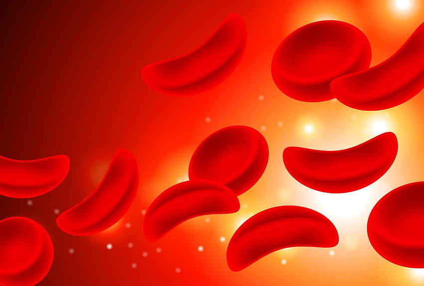 Cutting Away at Genetic Diseases Stemosphere [] for your , Mobile & Tablet. Explore Anemia Background. Anemia Background, Red Blood Cells HD wallpaper