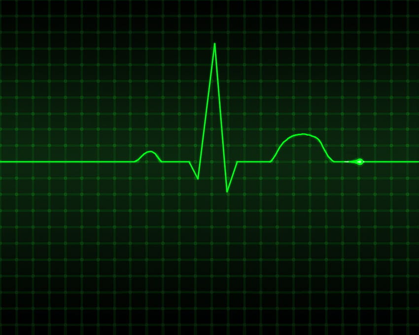 EKG . EKG , EKG, Cardiology HD wallpaper