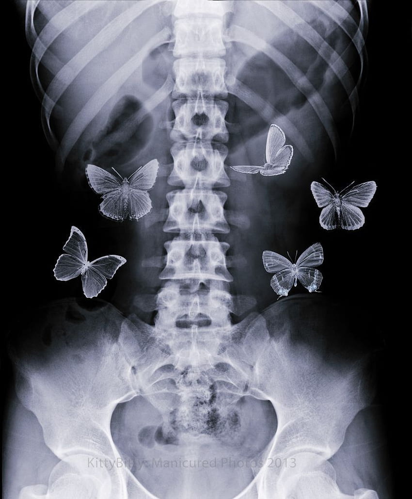 Borboletas. Arte estética, Cartaz de borboleta, Colagem estética, Estômago Papel de parede de celular HD