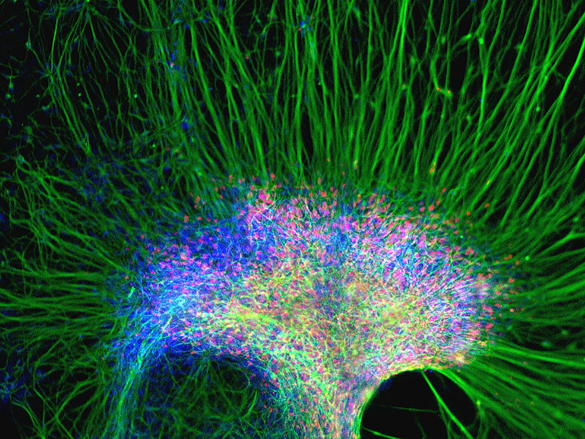 Клъстер от нервни клетки, цветове, зелено, клетки HD тапет