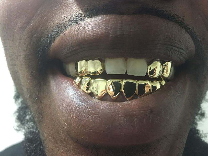 Gold teeth gold grillz perm cuts Specials in Homestead, FL - OfferUp HD wallpaper