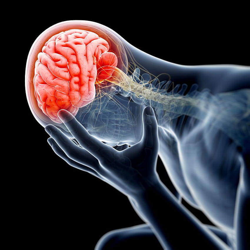 Lesão Cerebral, Neurológica mais vista Papel de parede de celular HD