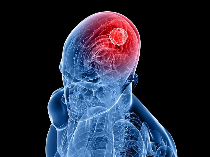 Minimalismo nero Persone Cervello Raggi X Viso Arte digitale Ossa Blu Rosso - Risoluzione: Sfondo HD