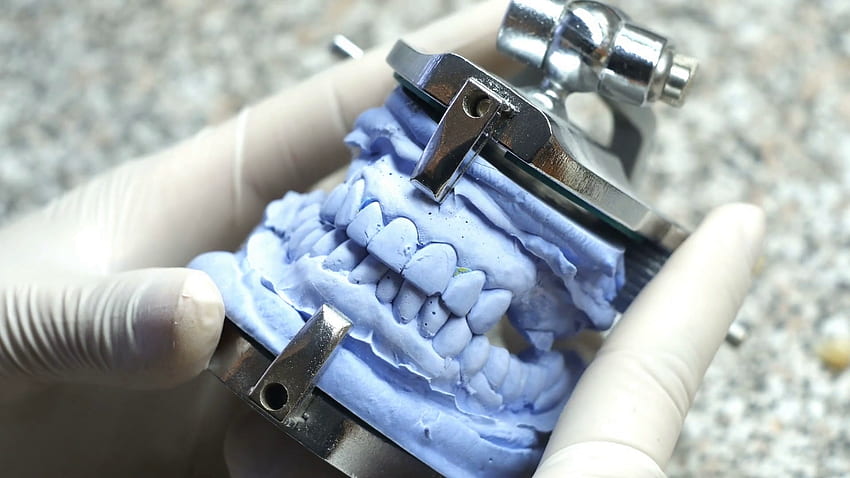 Nahaufnahme eines Zahntechnikers, der in einem Dentallabor Zahnersatz herstellt. Stock Video Footage, Dentallabor HD-Hintergrundbild