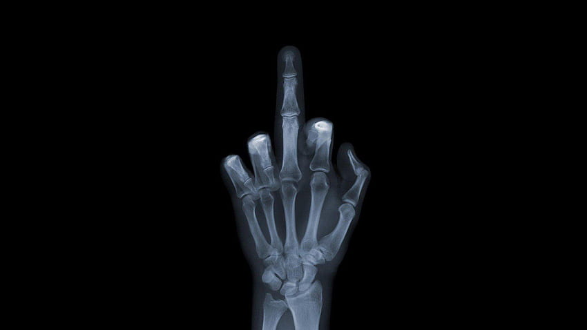 HANDS X Ray F*ck You Signal ., Radiography HD wallpaper