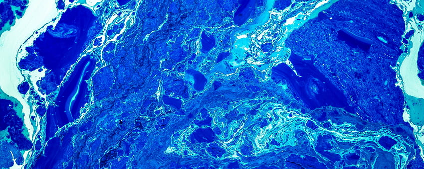 Spots, Stains, Bluish, Blue, Liquid - Green Aesthetic - HD wallpaper