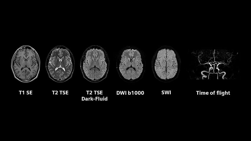 Siemens Healthineers Bergerak Ke Bidang Klinis Baru Dengan MRI Seluruh Tubuh Terkecil Dan Teringan, Ahli Teknologi Radiologi Wallpaper HD