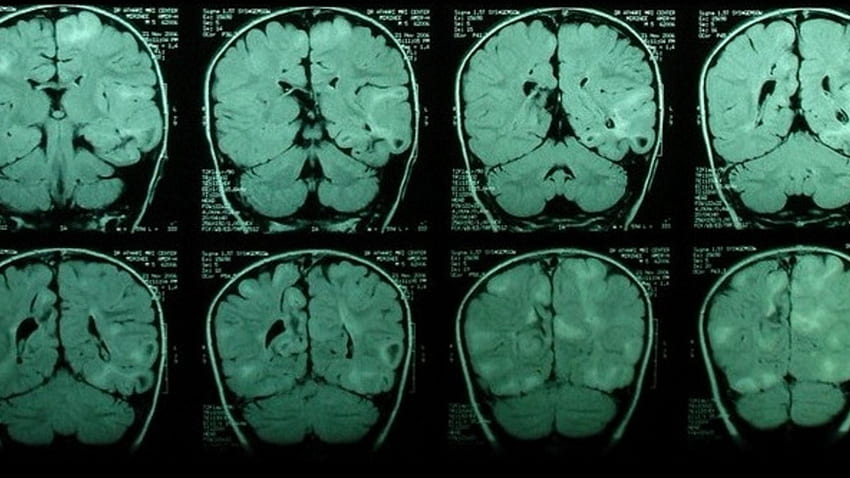 Teschi medicina cervello malattie medici scansioni mri Sfondo HD